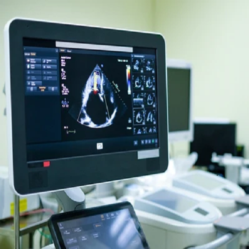 Dobutamine Stress Echocardiography